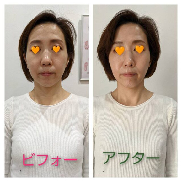 ビフォーアフター