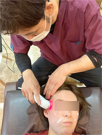 美顔ラジオ波の写真